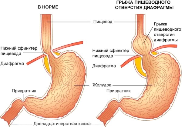 gryza-pishevoda.jpg